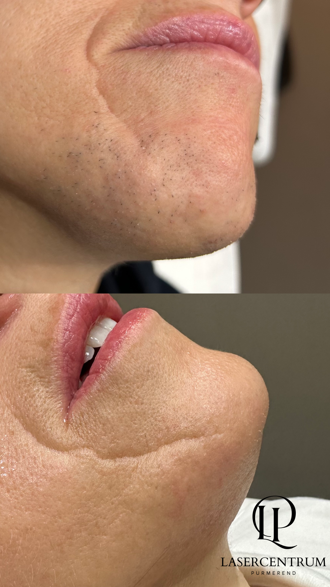 before-afters